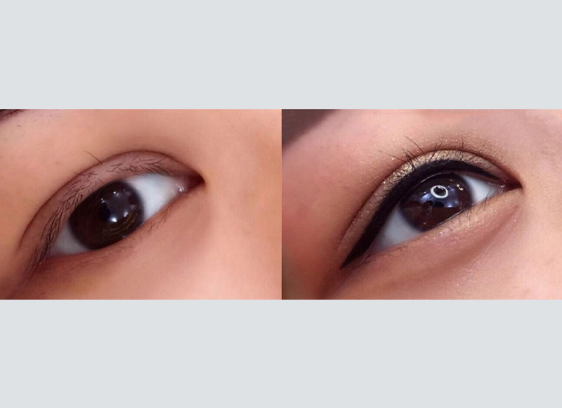 /
